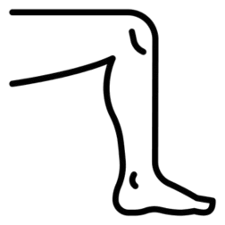 Leg pain